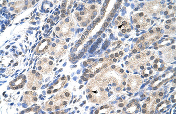 MSX2 Rabbit Polyclonal Antibody