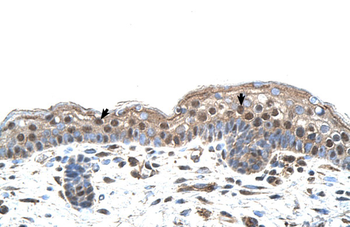 IRF4 Rabbit Polyclonal Antibody
