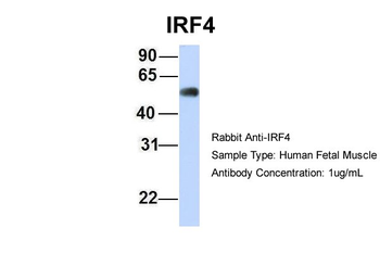 IRF4 Rabbit Polyclonal Antibody