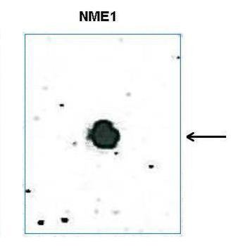 Nme1 Rabbit Polyclonal Antibody