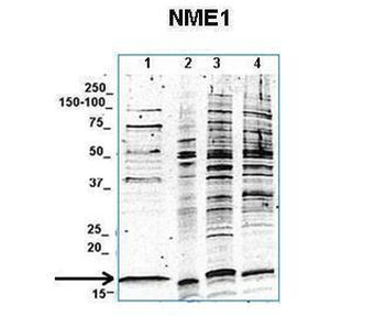 Nme1 Rabbit Polyclonal Antibody