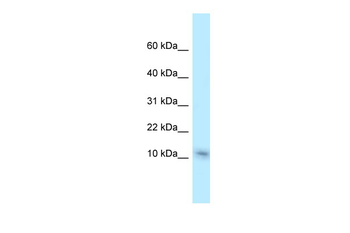 Nme1 Rabbit Polyclonal Antibody