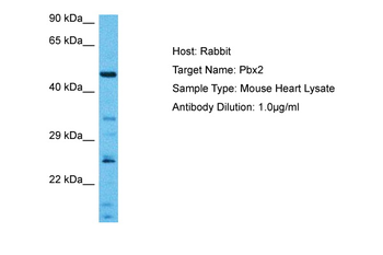PBX2 Rabbit Polyclonal Antibody