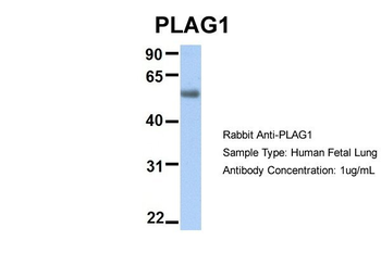 PLAG1 Rabbit Polyclonal Antibody