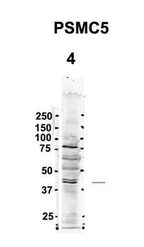 PSMC5 Rabbit Polyclonal Antibody
