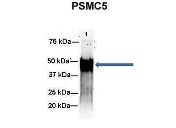 PSMC5 Rabbit Polyclonal Antibody