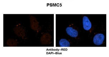 PSMC5 Rabbit Polyclonal Antibody