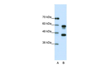 PSMC5 Rabbit Polyclonal Antibody