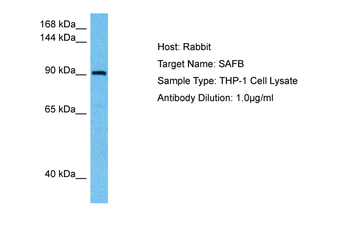 SAFB Rabbit Polyclonal Antibody