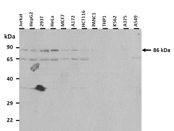 SATB1 Rabbit Polyclonal Antibody