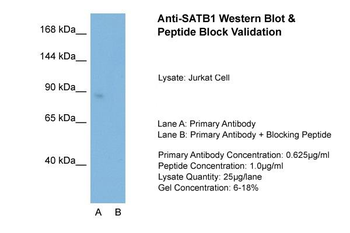 SATB1 Rabbit Polyclonal Antibody