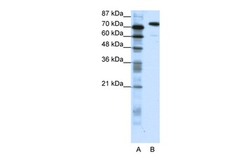 SATB1 Rabbit Polyclonal Antibody