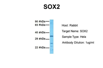 SOX2 Rabbit Polyclonal Antibody
