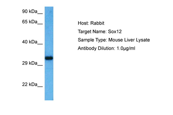 SOX4 Rabbit Polyclonal Antibody