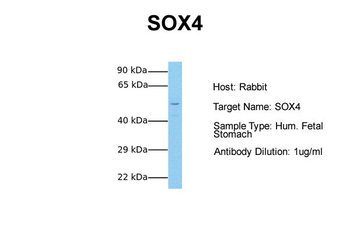 SOX4 Rabbit Polyclonal Antibody