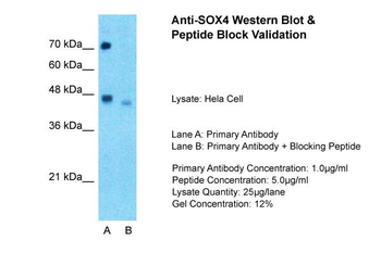 SOX4 Rabbit Polyclonal Antibody