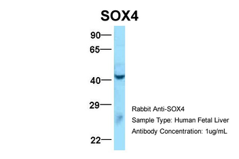 SOX4 Rabbit Polyclonal Antibody