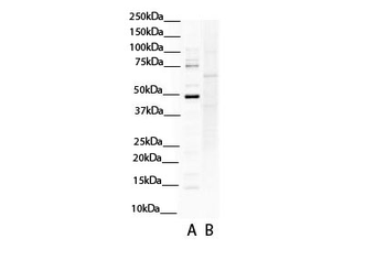 SOX4 Rabbit Polyclonal Antibody