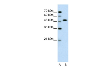 SOX11 Rabbit Polyclonal Antibody