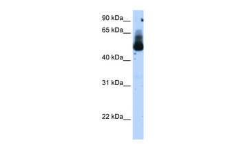 TRIM21 Rabbit Polyclonal Antibody