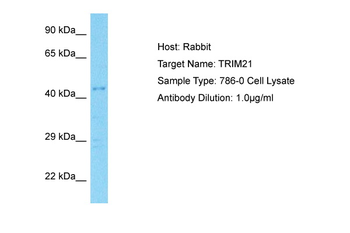 TRIM21 Rabbit Polyclonal Antibody