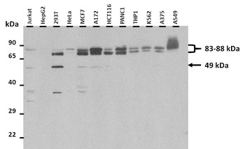 STAT3 Rabbit Polyclonal Antibody