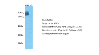 STAT3 Rabbit Polyclonal Antibody