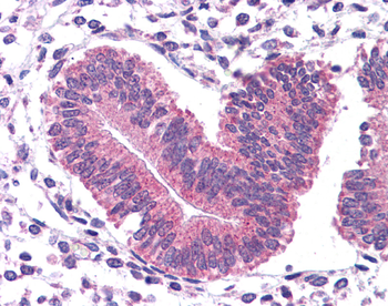 STAT3 Rabbit Polyclonal Antibody