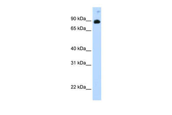 STAT6 Rabbit Polyclonal Antibody