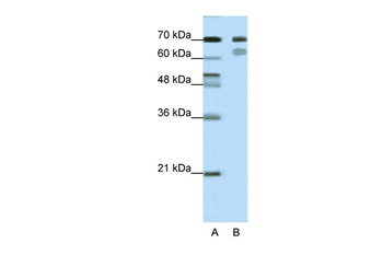 TCF3 Rabbit Polyclonal Antibody