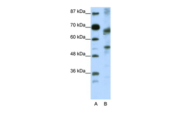TCF12 Rabbit Polyclonal Antibody