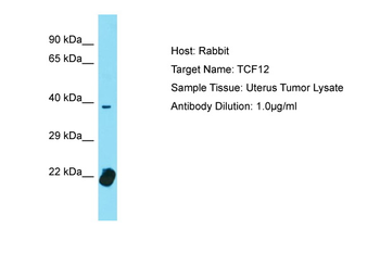 TCF4 Rabbit Polyclonal Antibody