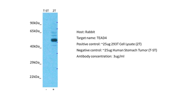 TEAD4 Rabbit Polyclonal Antibody