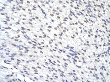 ZFP36 Rabbit Polyclonal Antibody