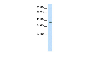 ZFP36 Rabbit Polyclonal Antibody