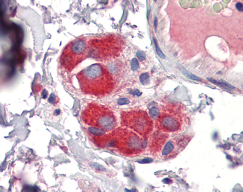 ZFP36 Rabbit Polyclonal Antibody
