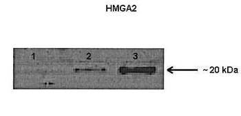 HMGA2 Rabbit Polyclonal Antibody