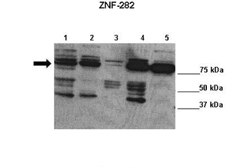 ZNF282 Rabbit Polyclonal Antibody