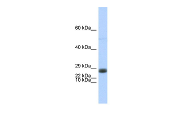 EDF1 Rabbit Polyclonal Antibody