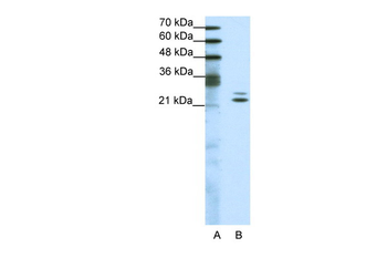 BUD31 Rabbit Polyclonal Antibody