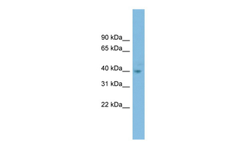 FOXH1 Rabbit Polyclonal Antibody
