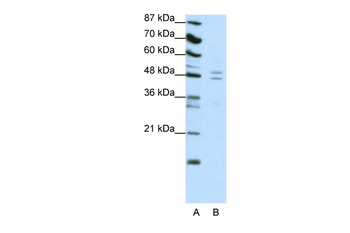 TANK Rabbit Polyclonal Antibody