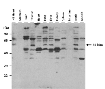 KLF4 Rabbit Polyclonal Antibody