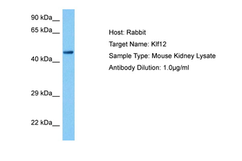 KLF4 Rabbit Polyclonal Antibody