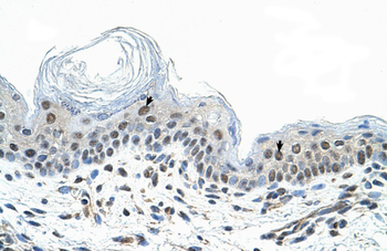 COPS2 Rabbit Polyclonal Antibody