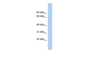 TRIP13 Rabbit Polyclonal Antibody