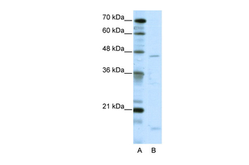 TRIP13 Rabbit Polyclonal Antibody