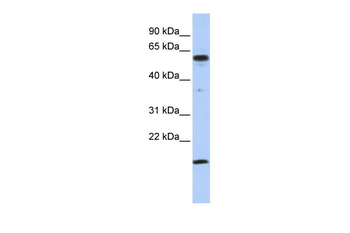 TRIP10 Rabbit Polyclonal Antibody