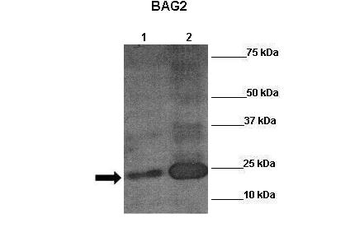 RUNX2 Rabbit Polyclonal Antibody