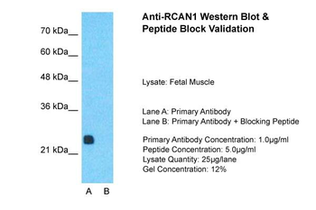 RCAN1 Rabbit Polyclonal Antibody